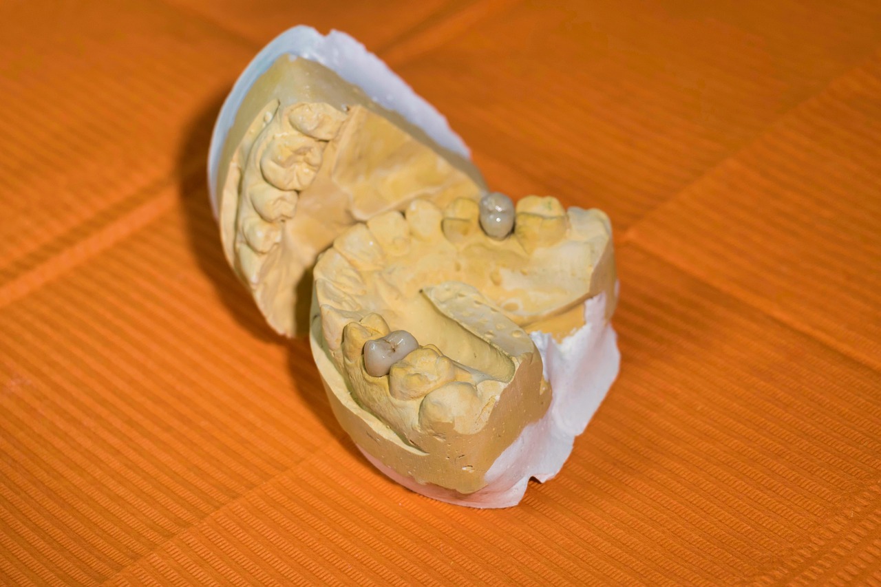 ¿Cómo quitar el dolor de caries en la muela?