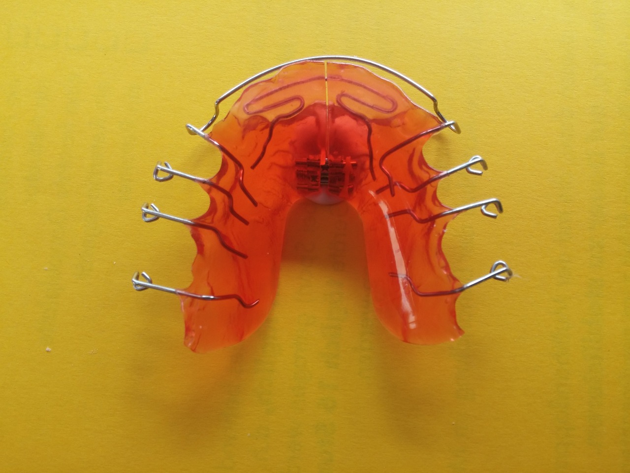 ¿Cuánto tiempo dura la ferula dental?
