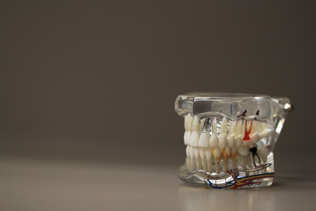 ¿Cuántas piezas dentales hay en total?