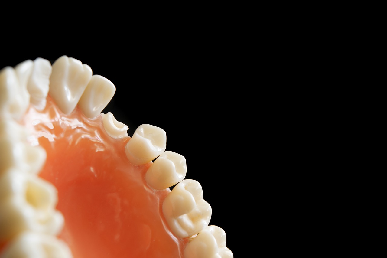 ¿Cómo se quitan las caries en el dentista?