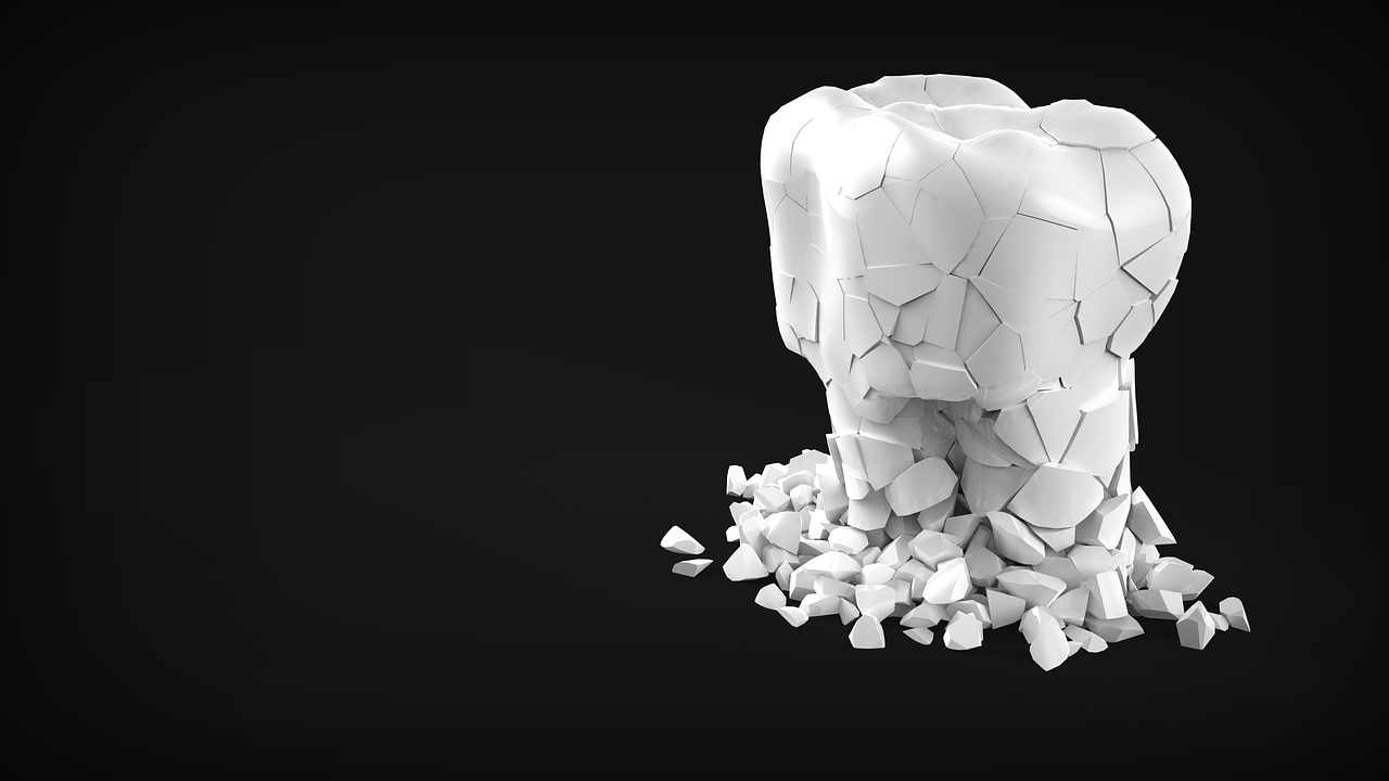 Is Dentistry in Spain expensive?