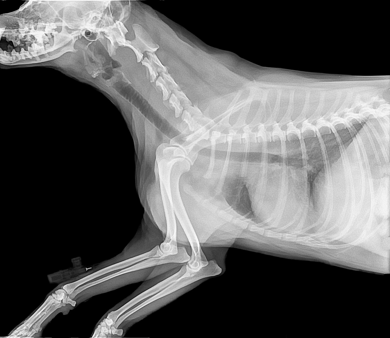 ¿Qué se puede ver en una radiografía de cuello?