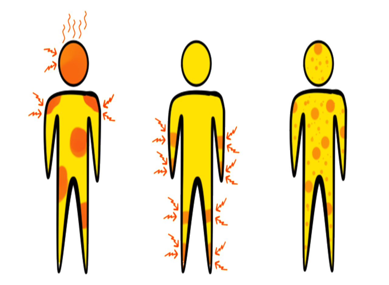 ¿Qué síntomas quedan después de la anestesia?