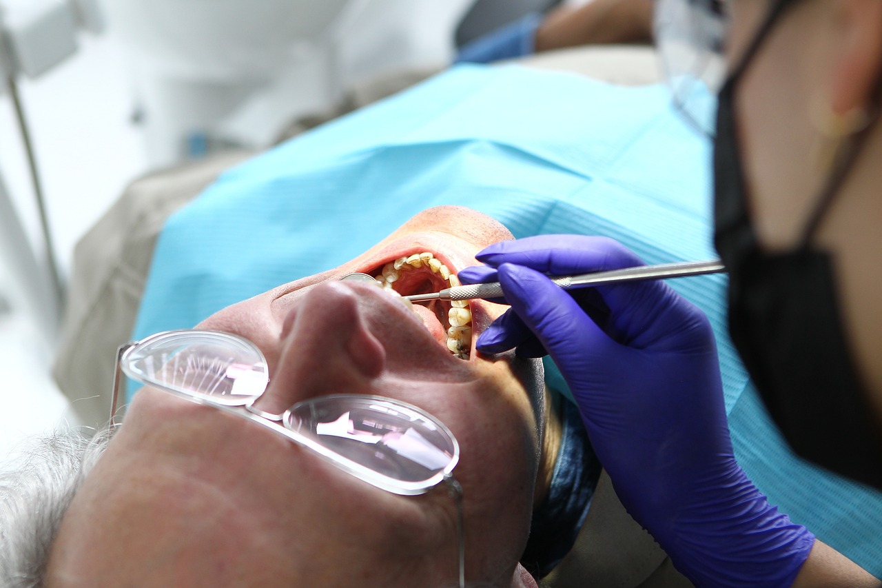 ¿Qué tipos de blanqueamientos dentales hay?