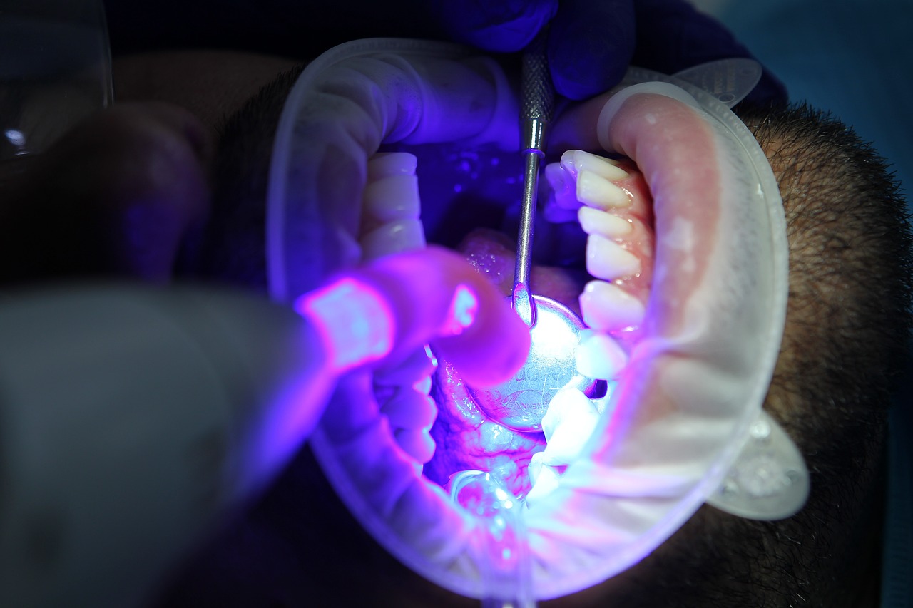 ¿Cómo hacer para quitar el color amarillo de los dientes?