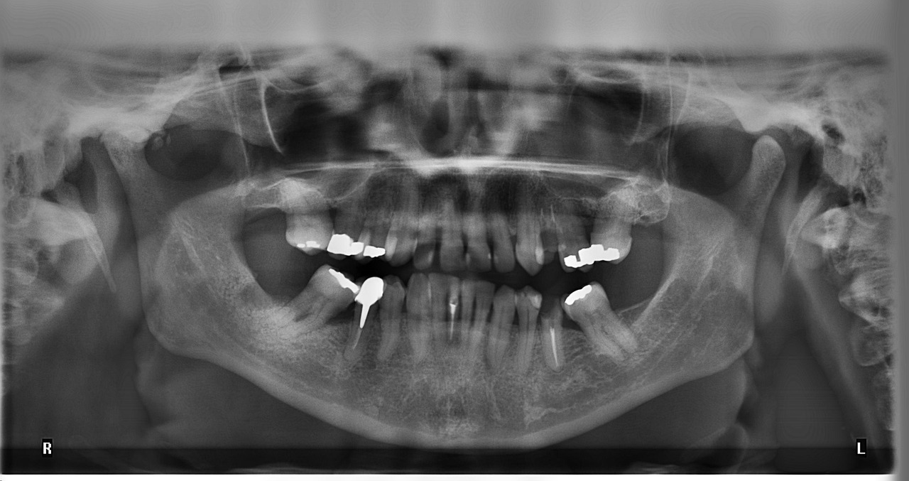¿Qué tipo de empaste dental es mejor?