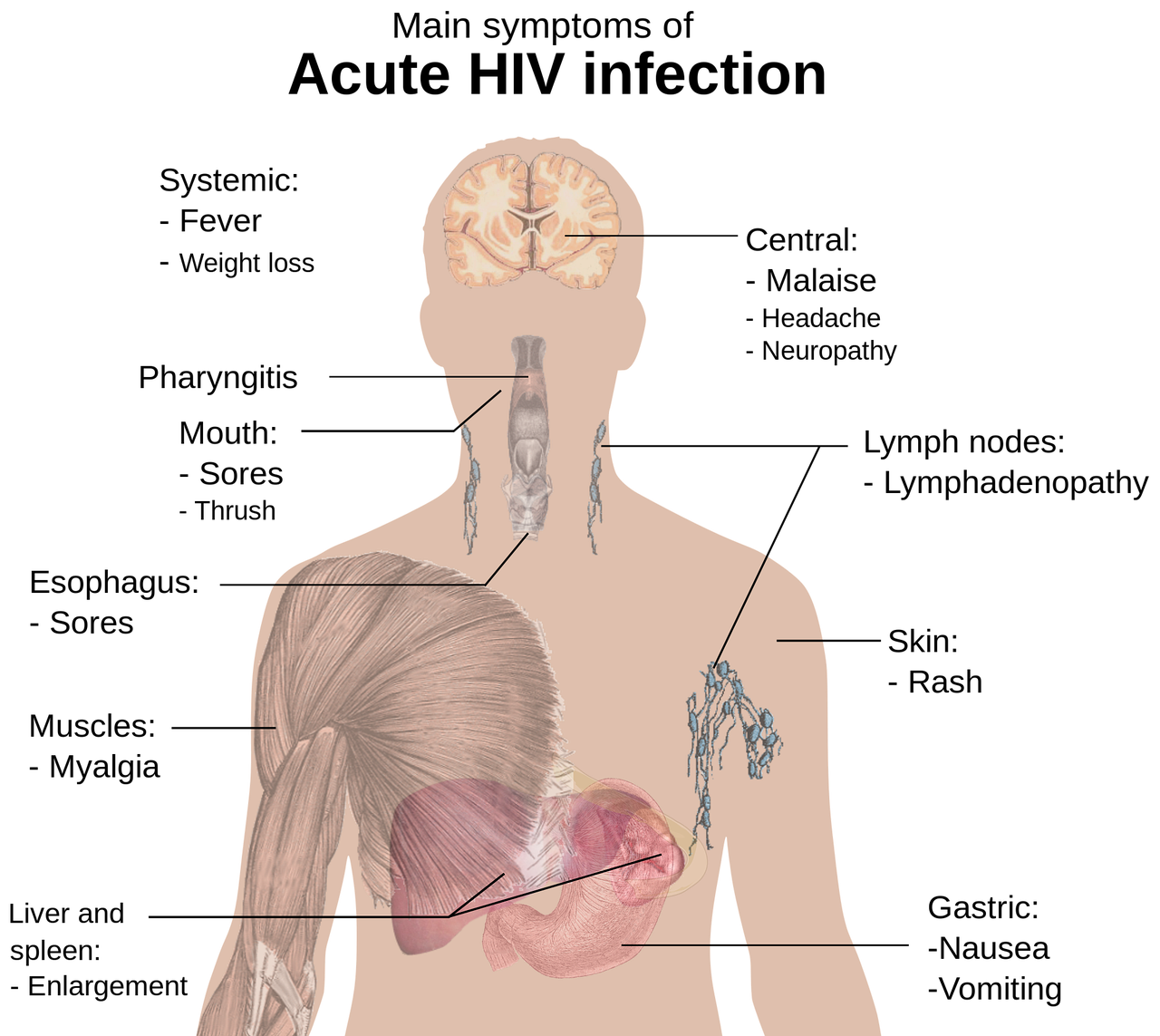 ¿Cuáles son los síntomas de pulpitis?