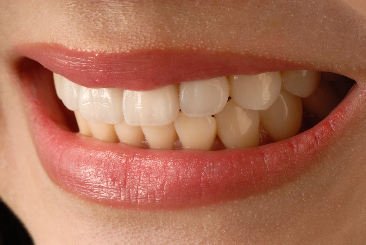 ¿Cuánto tiempo duran las carillas en los dientes?