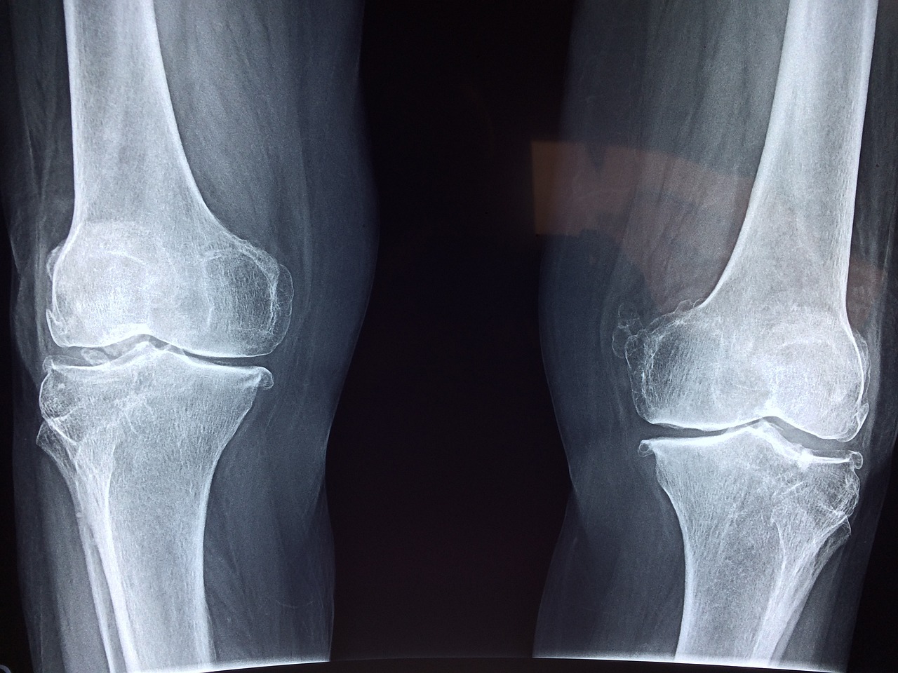 ¿Cómo afectan los rayos X al cuerpo?