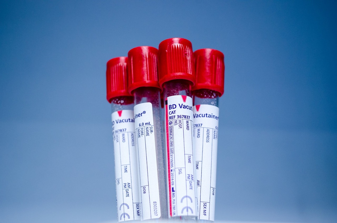 ¿Cuáles son los requisitos para donar sangre?