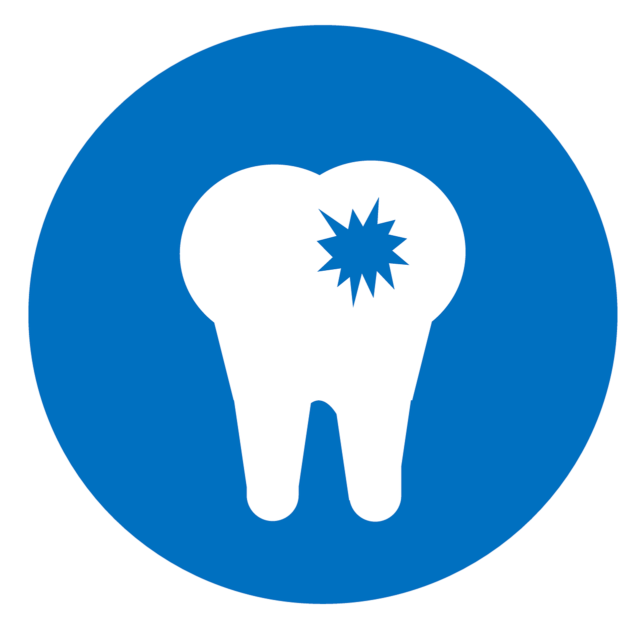 ¿Qué pasa si un diente de leche tiene caries?