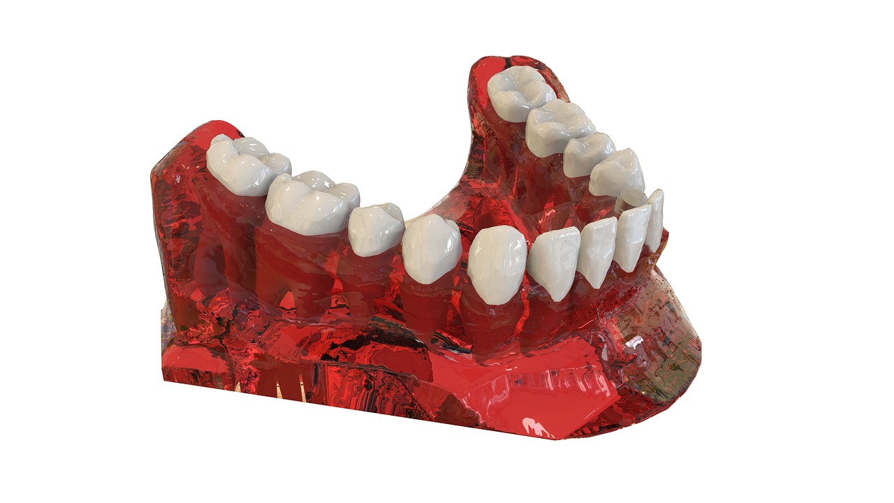 ¿Cómo corregir la mala alineacion de los dientes?