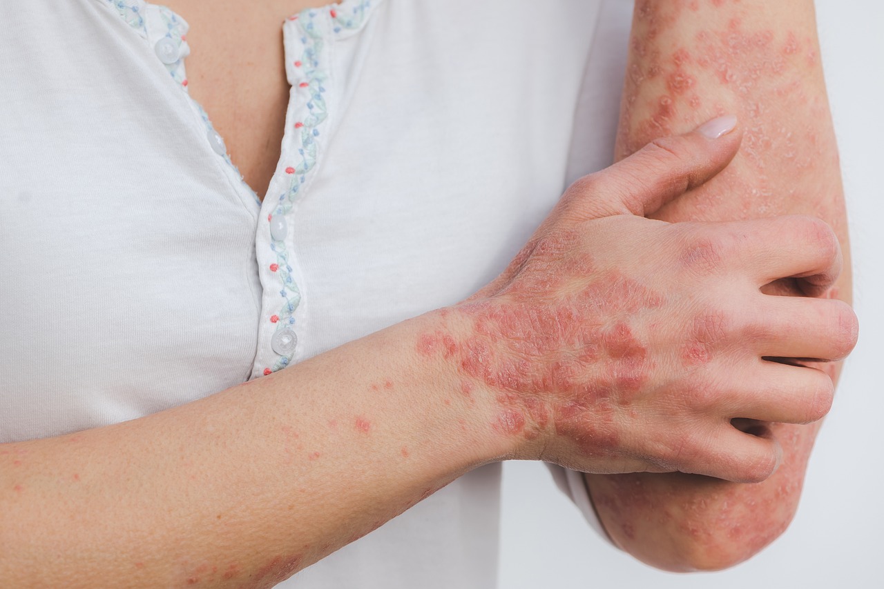 ¿Cómo se quita la inflamación de la garganta?