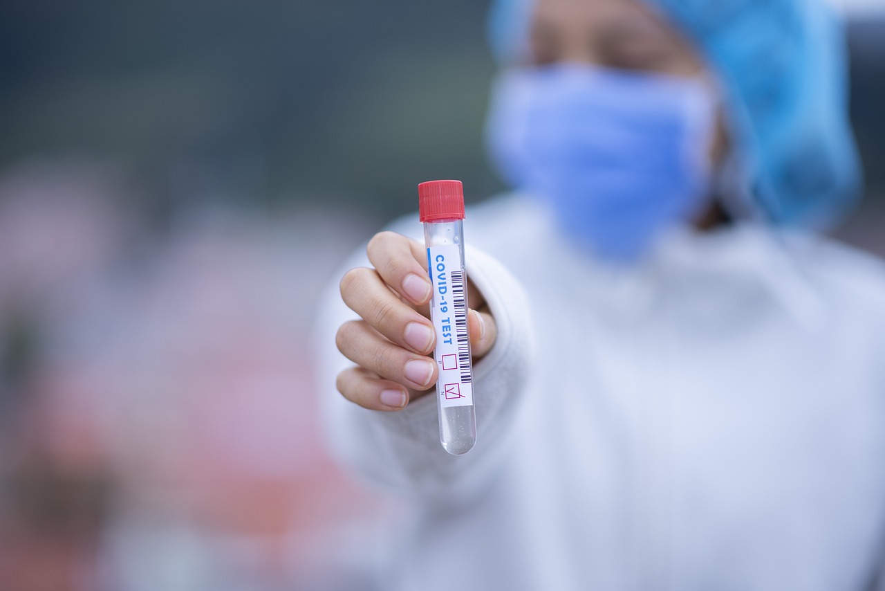 ¿Cuándo hay que hacer el test Covid?