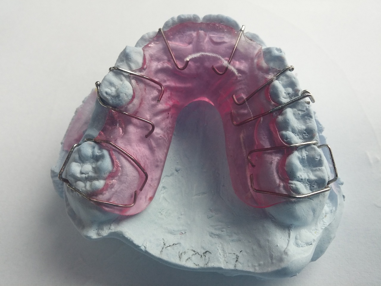 ¿Qué ferula dental es mejor?