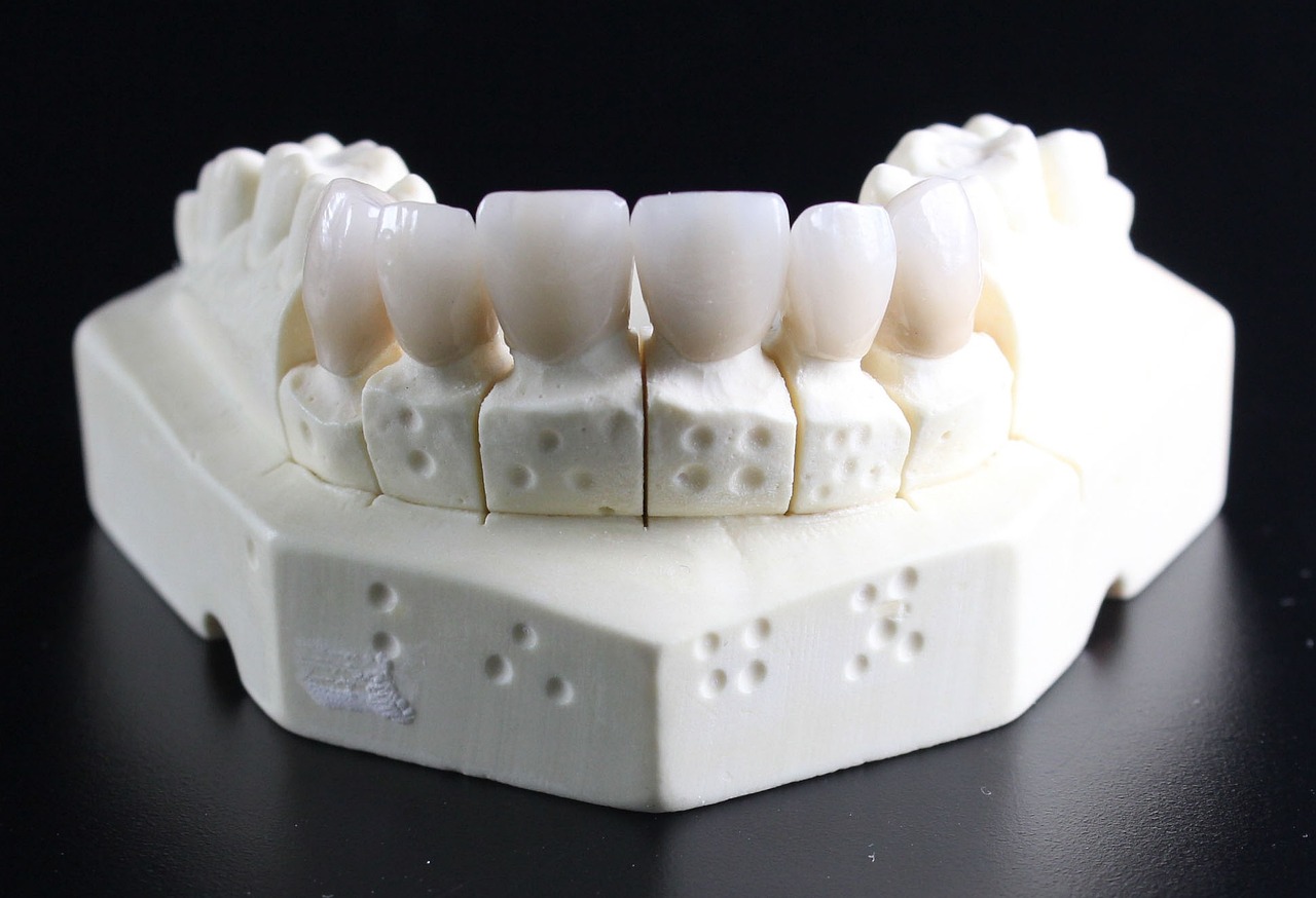 ¿Cómo poner blancos los dientes postizos?
