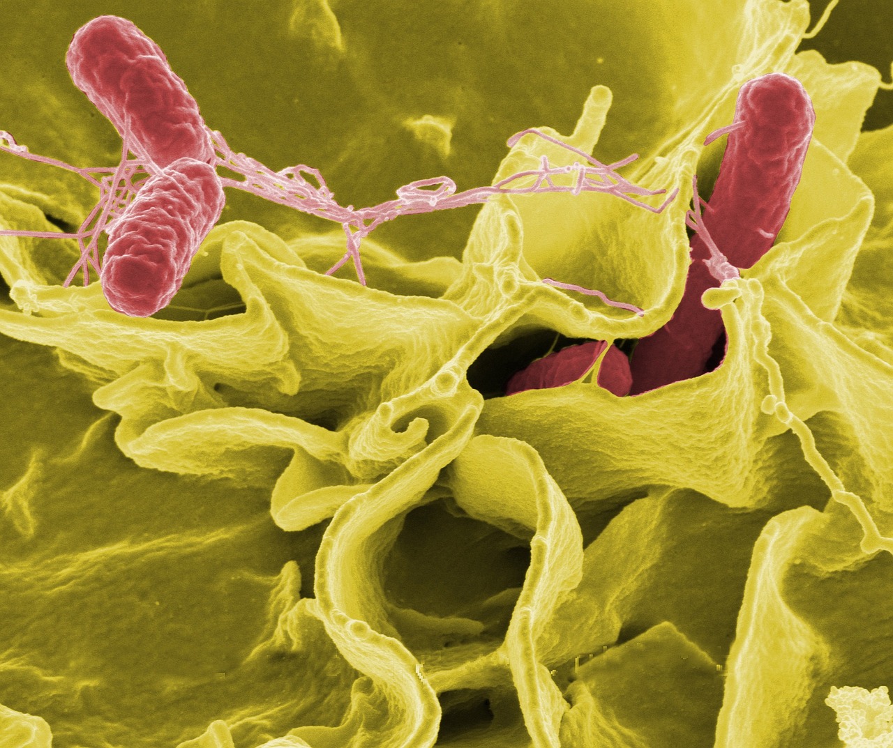 ¿Cómo curar una bacteria en la lengua?