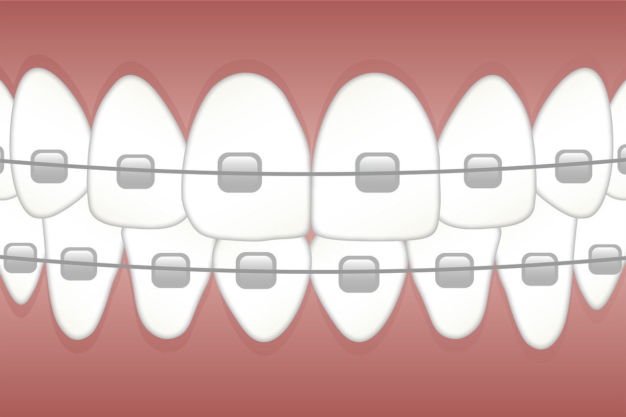 ¿Qué es bueno para fijar los dientes?