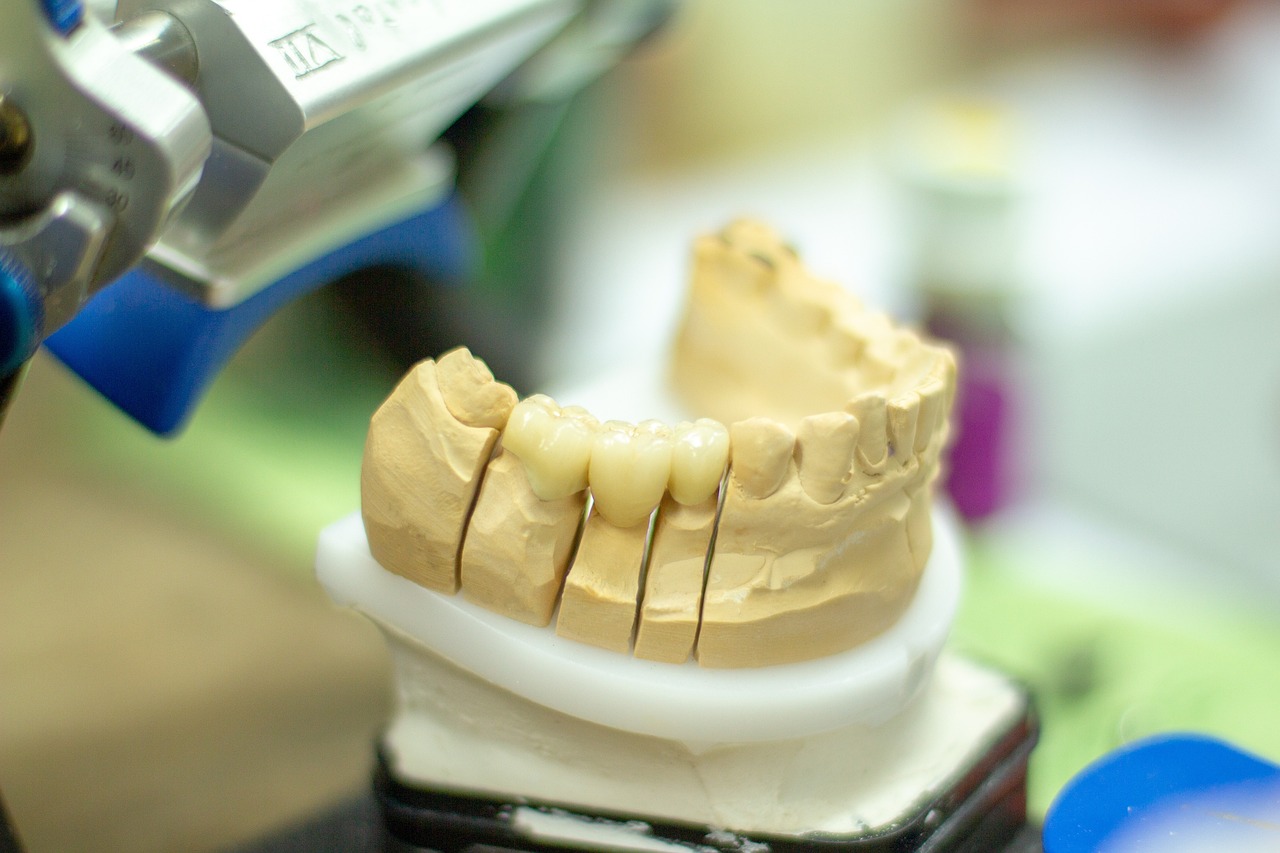 ¿Qué tipo de dentadura postiza es mejor?