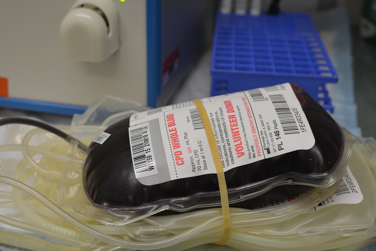¿Qué pasa si dono sangre con muela picada?
