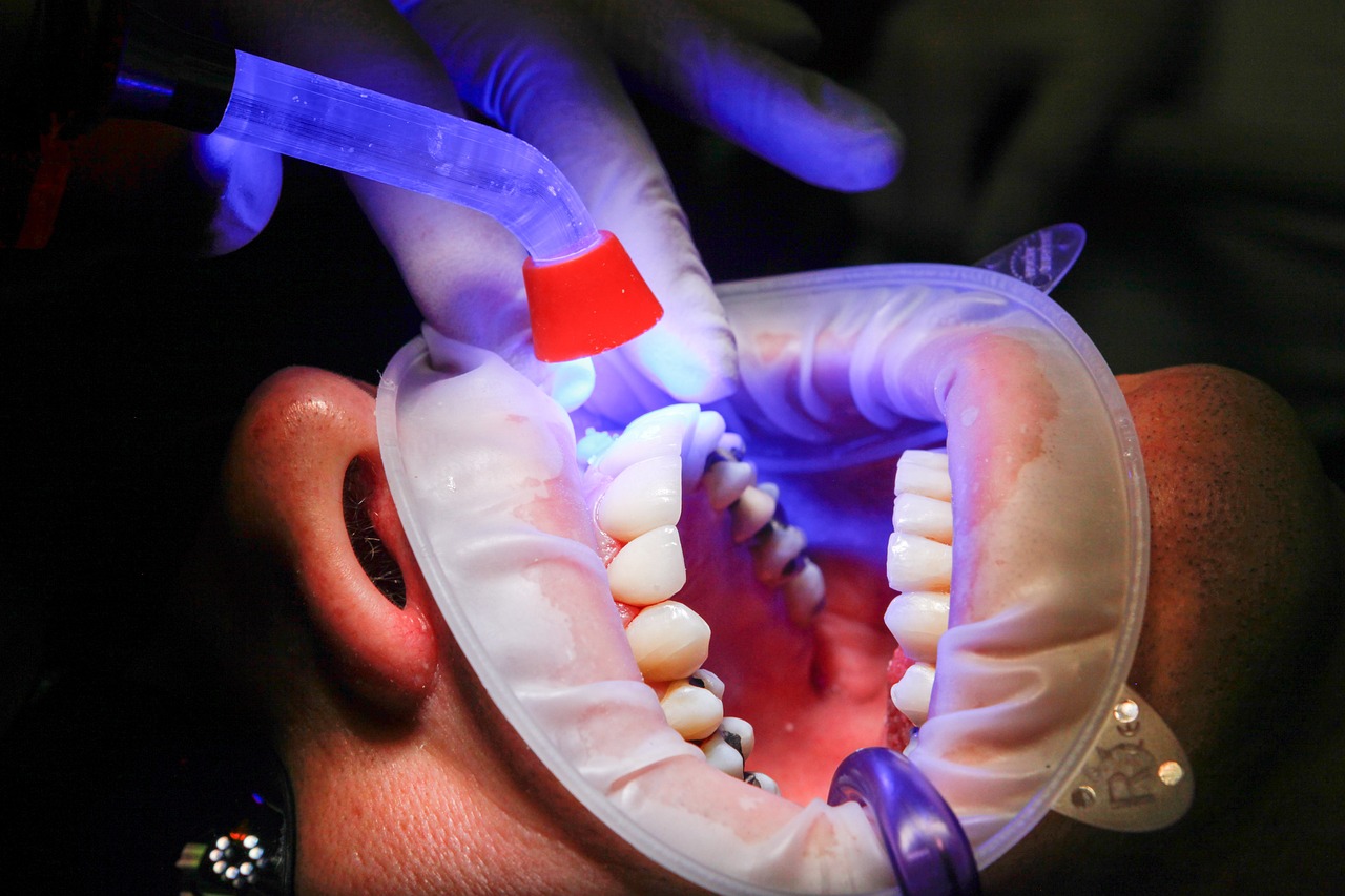 What is the dentist version of MD?