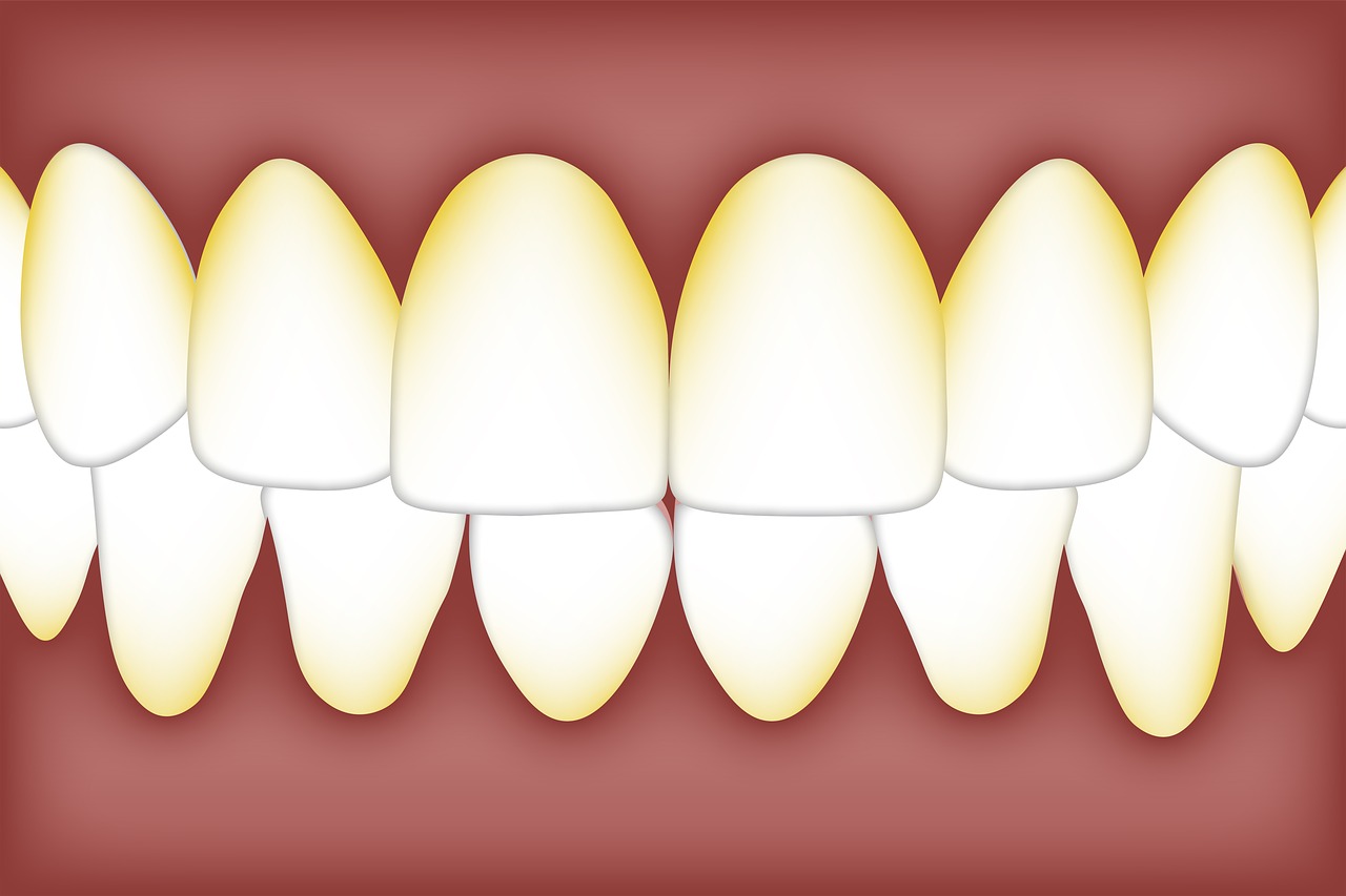 ¿Cómo eliminar la placa de los dientes?