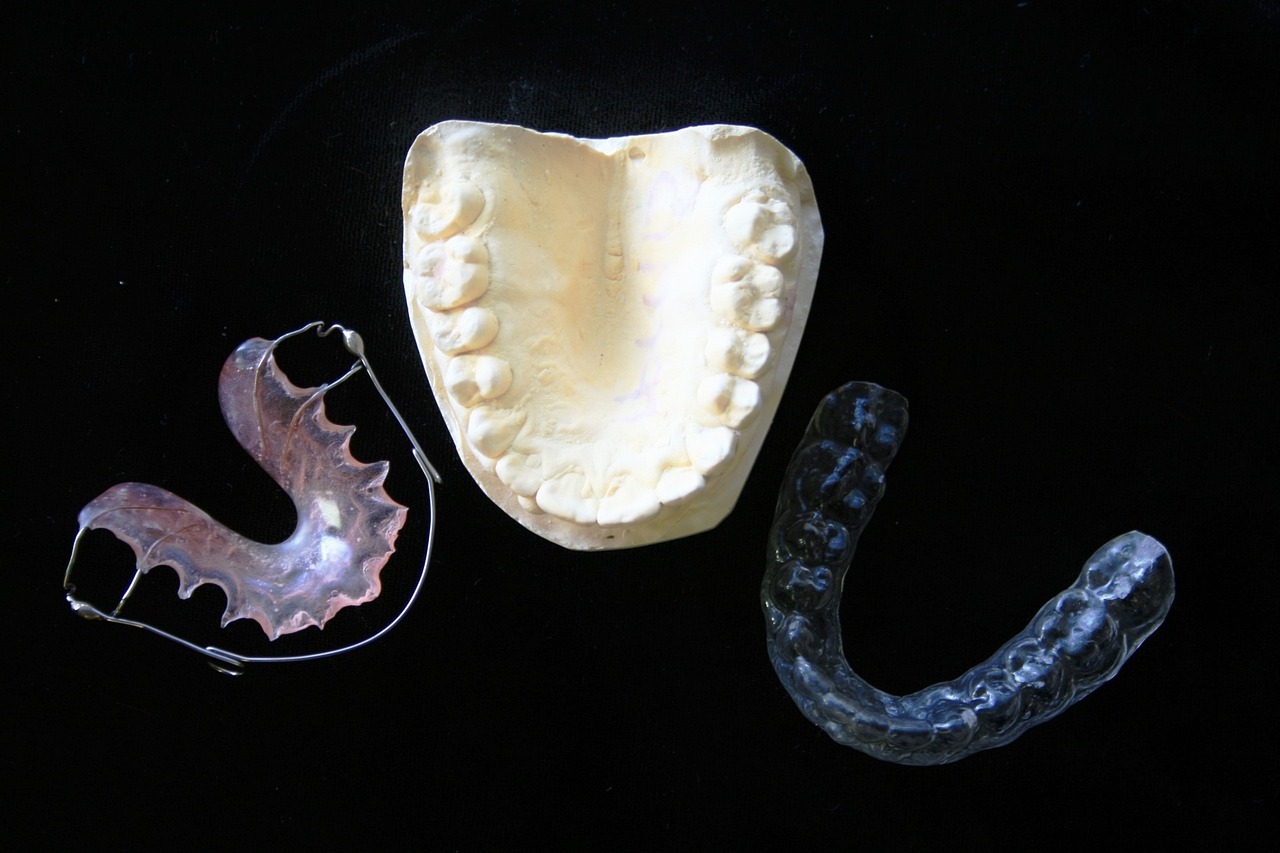 ¿Cómo se llama el aparato que se coloca en los dientes?
