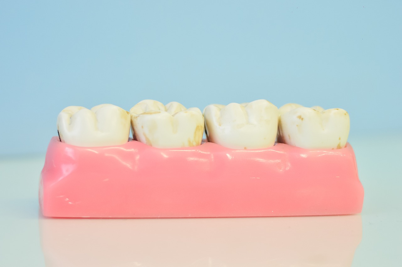 ¿Qué diferencia hay entre un odontólogo y un periodoncista?