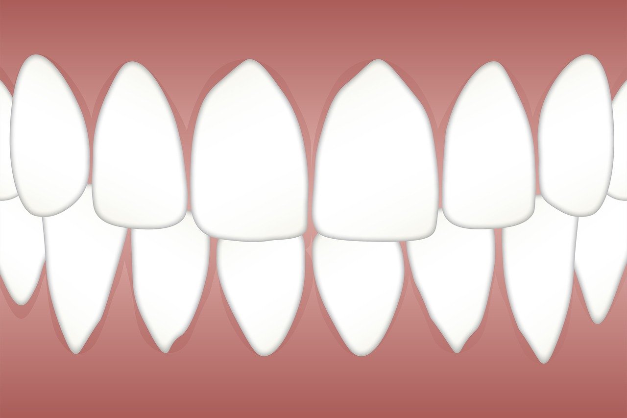 ¿Qué es un examen periodontal?
