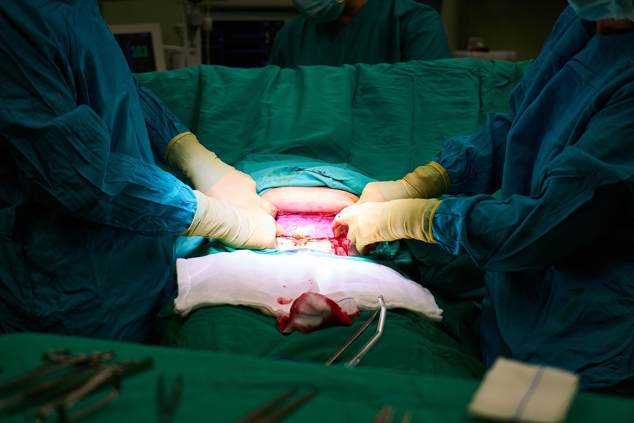¿Cómo quitarte una muela sin dolor?