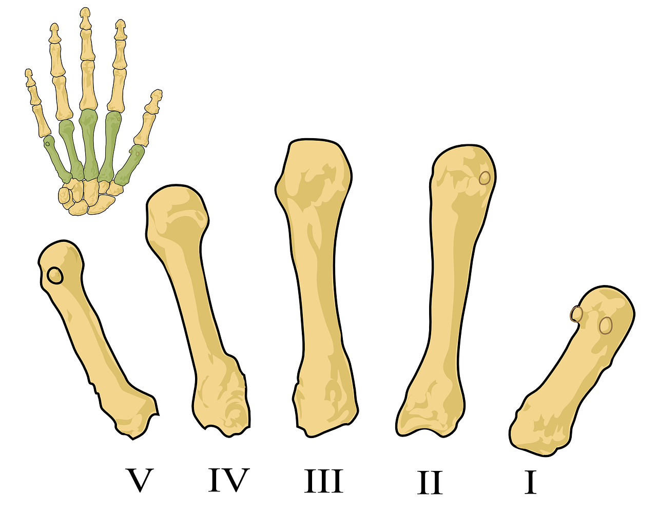 ¿Qué duele cuando hay osteoporosis?