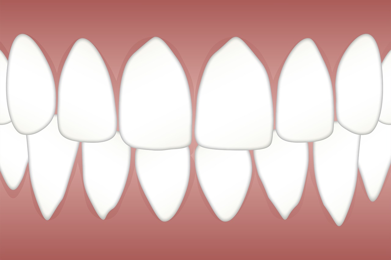 ¿Qué es un curetaje periodontal?