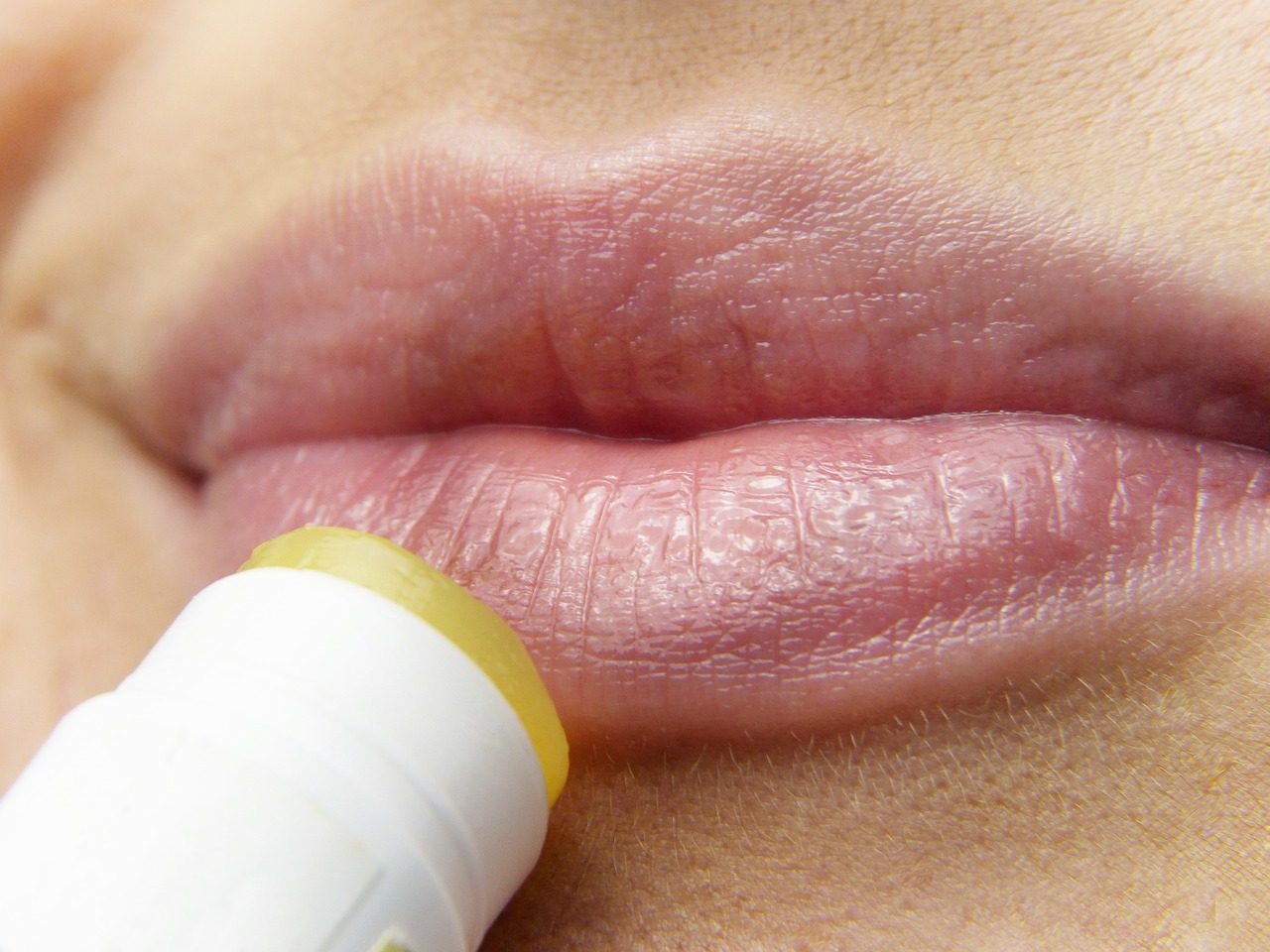 ¿Cómo curar el herpes en los labios rápidamente?