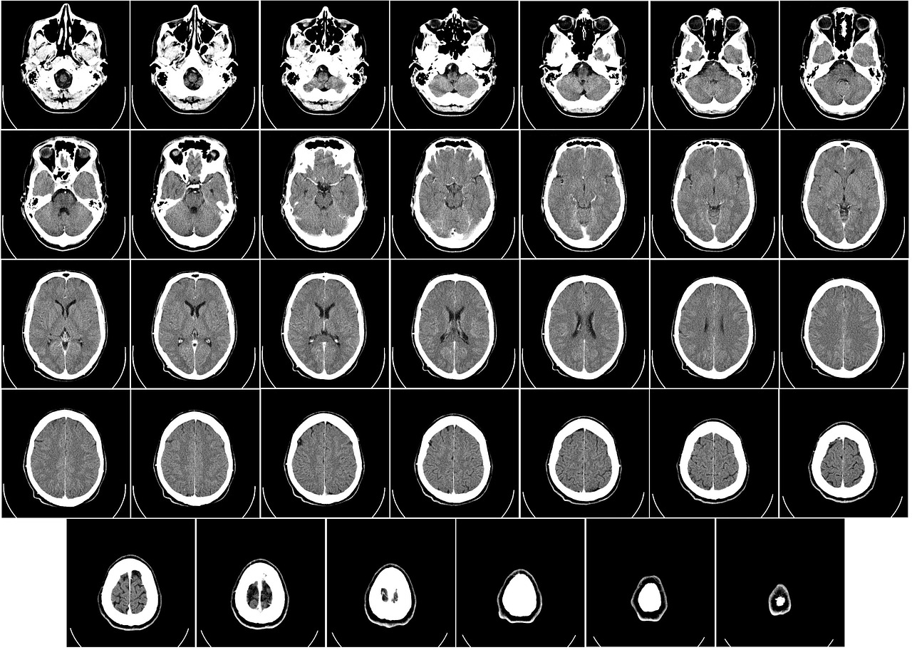 ¿Cuáles son los tipos de radiografías intraorales?