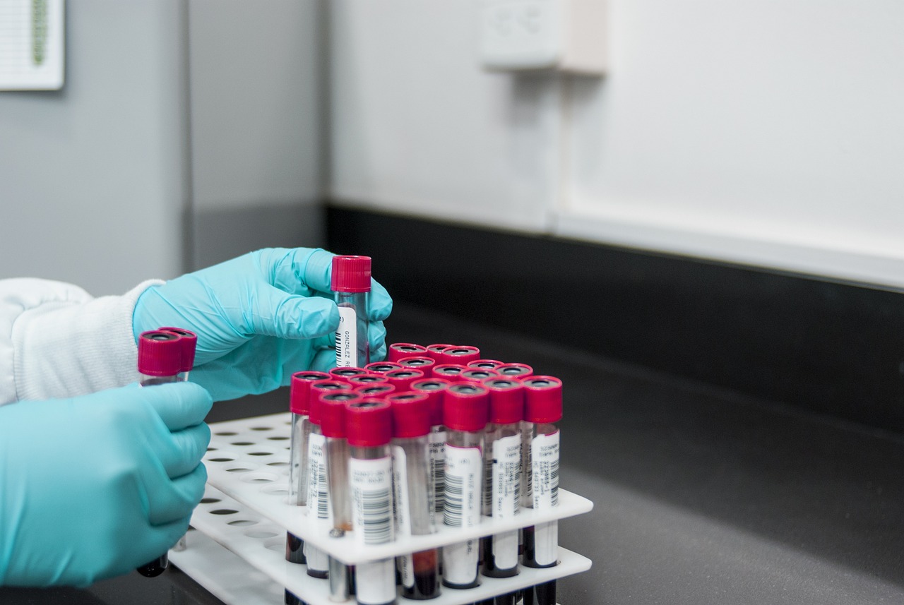 ¿Cuándo preocuparse por mocos con sangre?