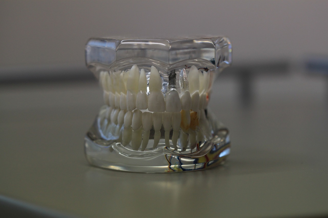 ¿Cómo se ve una dentadura saludable?