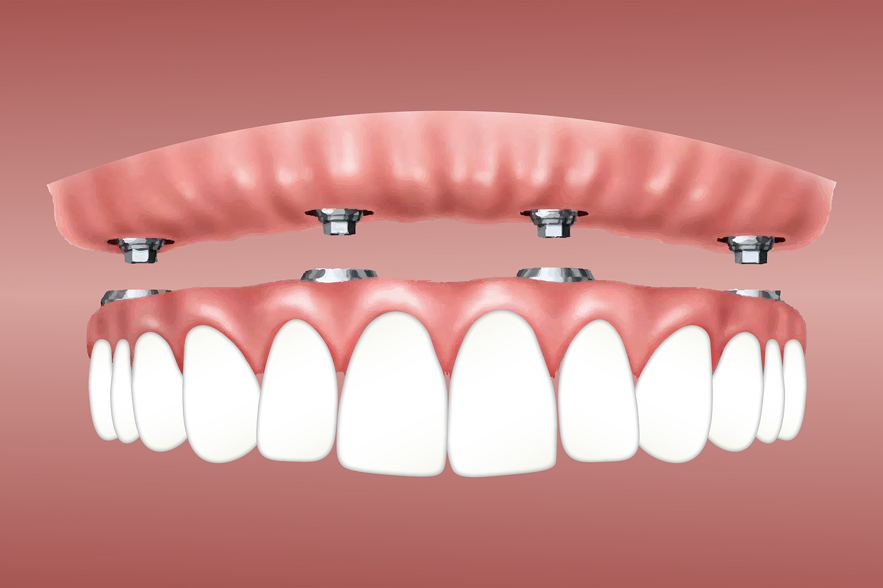 ¿Qué puedo hacer si no tengo dientes?