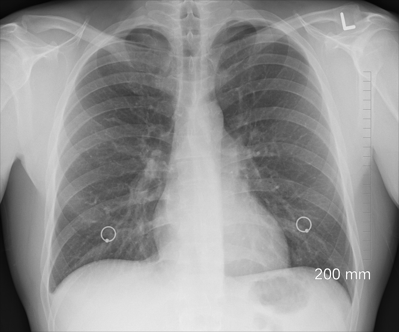 ¿Cómo sabemos que una radiografía de los dientes salió bien?