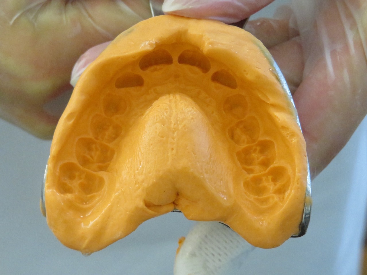 ¿Qué problemas pueden tener los dientes?